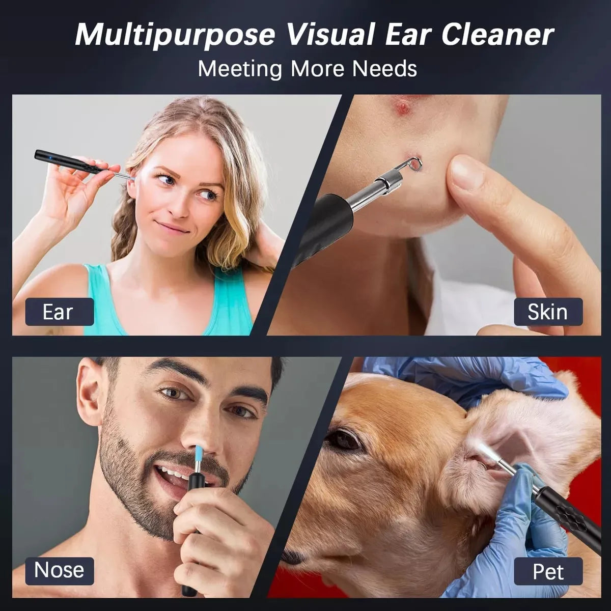 Limpiador de Oídos Inteligente con Cámara HD 1080P | Extractor de Puntos Negros | WiFi