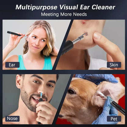 Limpiador de Oídos Inteligente con Cámara HD 1080P | Extractor de Puntos Negros | WiFi