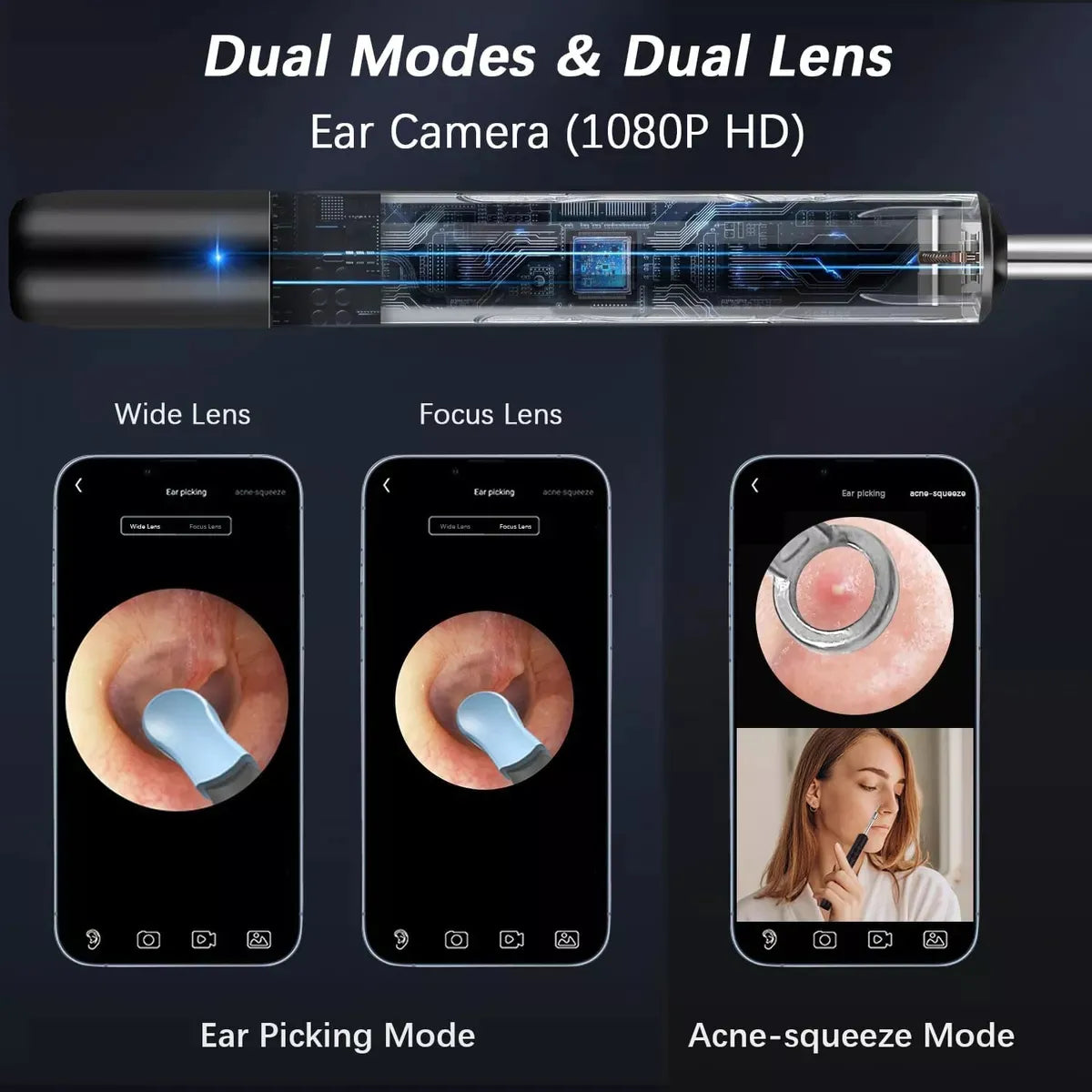 Limpiador de Oídos Inteligente con Cámara HD 1080P | Extractor de Puntos Negros | WiFi